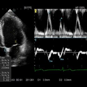 Dormed Hellas AR65 - Dual Gate Doppler