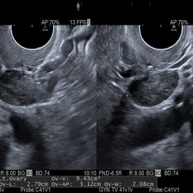 Dormed Hellas AR65 - GYN