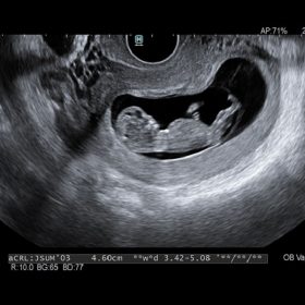 Dormed Hellas AR65 - OB 2