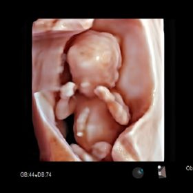 Dormed Hellas AR65 - OB 4D