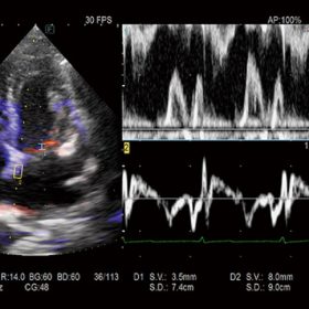 Dormed Hellas ARIETTA AR650 - Dual Gate Doppler