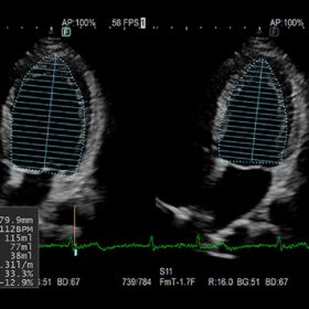 Dormed Hellas ARIETTA AR650 - GLS&EF
