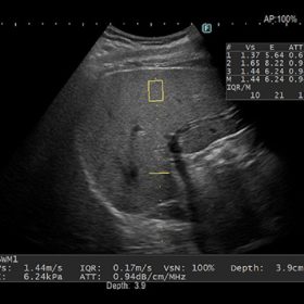 Dormed Hellas ARIETTA AR650 - SWM Liver