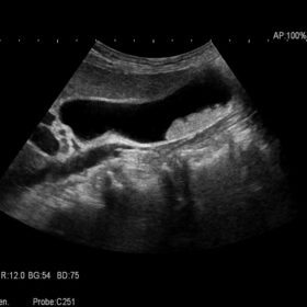 Dormed Hellas AR70 - Abdomem