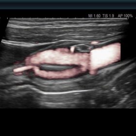 Dormed Hellas 750 Ultrasound