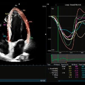 Dormed Hellas 750 Ultrasound