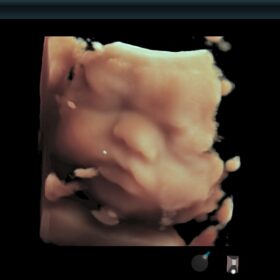 Dormed Hellas AR850 - 4D Auto Clipper