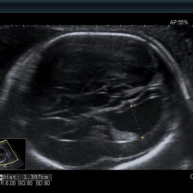 Dormed Hellas AR850 - OB