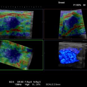 Dormed Hellas Ascendus - 4D Elasto Breast