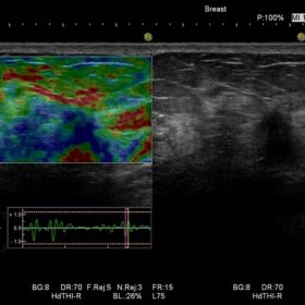 Dormed Hellas Ascendus - Breast Strain Ratio