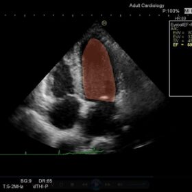 Dormed Hellas Dormed Hellas Ascendus - Cardiac EyeballEF