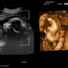 Dormed Hellas Ascendus - OB 4D