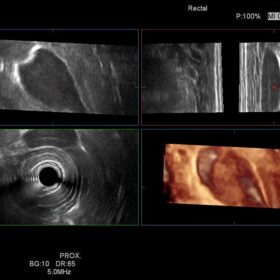 Dormed Hellas Ascendus - Rectal 3D