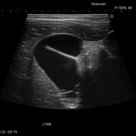 Dormed Hellas Avius - Abdomen