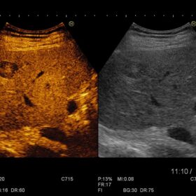 Dormed Hellas Avius - Contrast