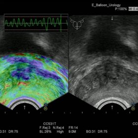 Dormed Hellas Avius - Elasto Urology