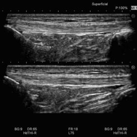 Dormed Hellas Avius - Superficial, Leg