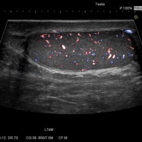 Dormed Hellas Avius - Testis Fine Flow