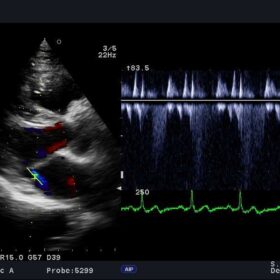 Dormed Hellas Ultrasound