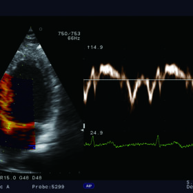 Dormed Hellas F31 - Cardio TDI