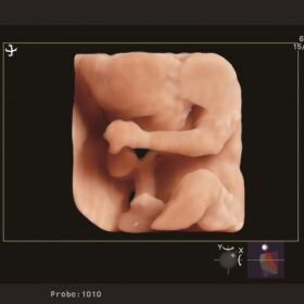 Dormed Hellas Ultrasound