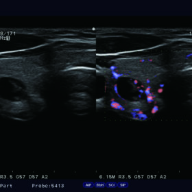 Dormed Hellas Ultrasound