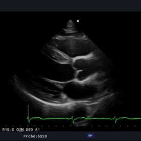 Dormed Hellas Ultrasound