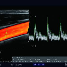 Dormed Hellas Ultrasound