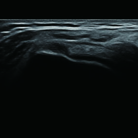 Dormed Hellas F37 - SIP