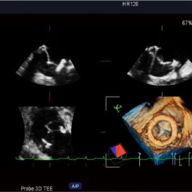 Dormed Hellas F75 - Cardio TEE 3D