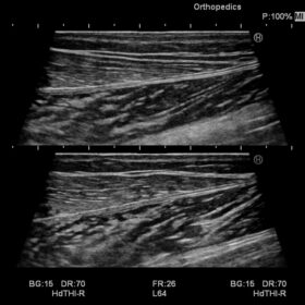 Dormed Hellas Noblus - Legs