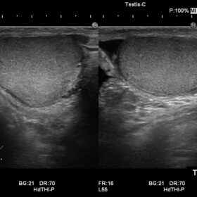 Dormed Hellas Noblus - Testis