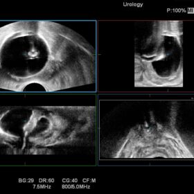Dormed Hellas Noblus - Urology Bi-plane 3D