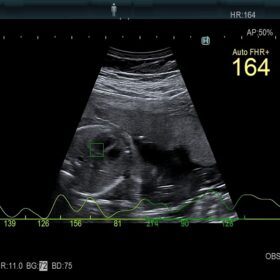 Dormed Hellas AR750 Fetal Heart Rate