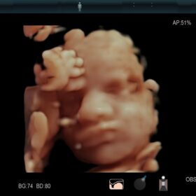 Dormed Hellas AR750 Fatal 4D