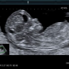 Dormed Hellas AR750 Obstetrics Zoom