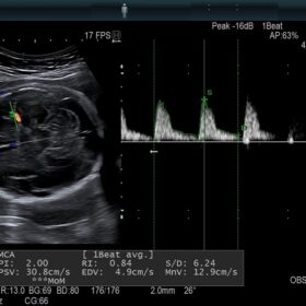 Dormed Hellas AR750 MCA