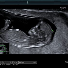 Dormed Hellas AR750 Obstetrics