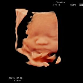 Dormed Hellas HI VISION Preirus