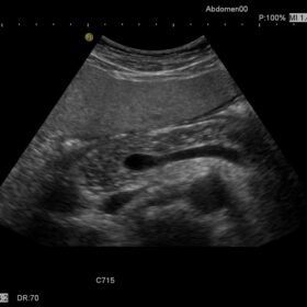 Dormed Hellas HI VISION Preirus