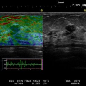 Dormed Hellas HI VISION Preirus