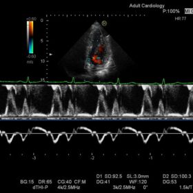 Dormed Hellas HI VISION Preirus