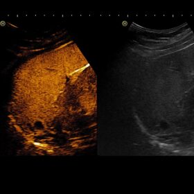 Dormed Hellas HI VISION Preirus