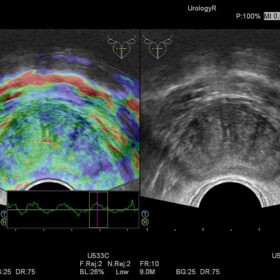 Dormed Hellas Preirus - Elasto Urology