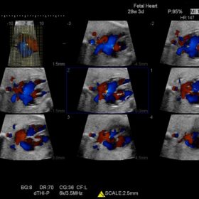 Dormed Hellas Preirus - STIC