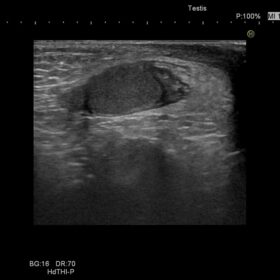 Dormed Hellas Preirus - Testis