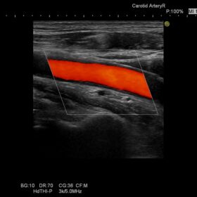 Dormed Hellas Preirus - Vascular