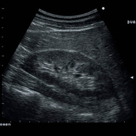 Dormed Hellas Prosound 6 - Kidney