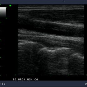 Dormed Hellas Aloka Prosound SSD-3500SX