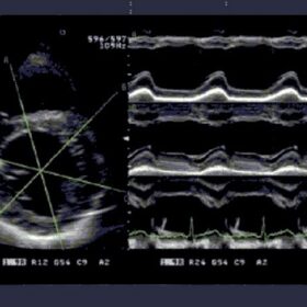 Dormed Hellas SSD-4000 - Cardio FAM